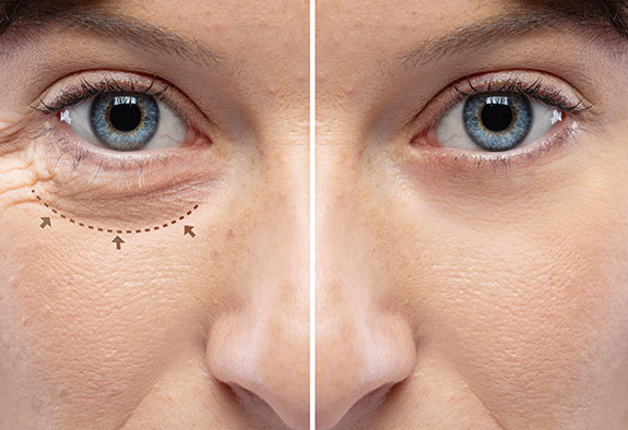 Chirurgie de visage Chirurgie de visage